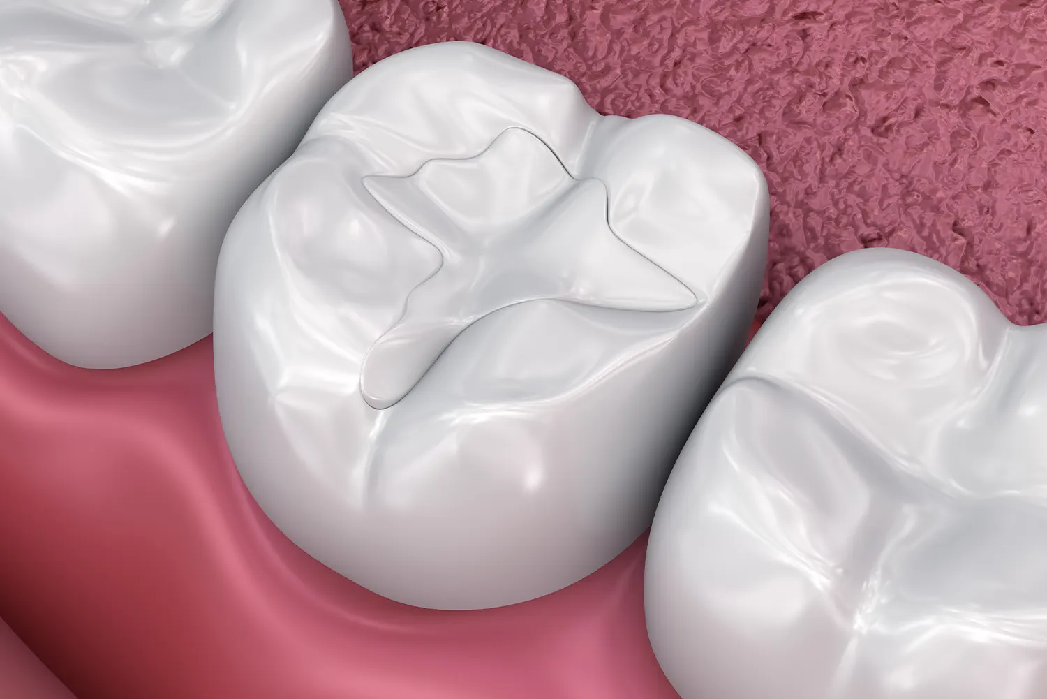 Preparing Your Child for a Cavity Filling