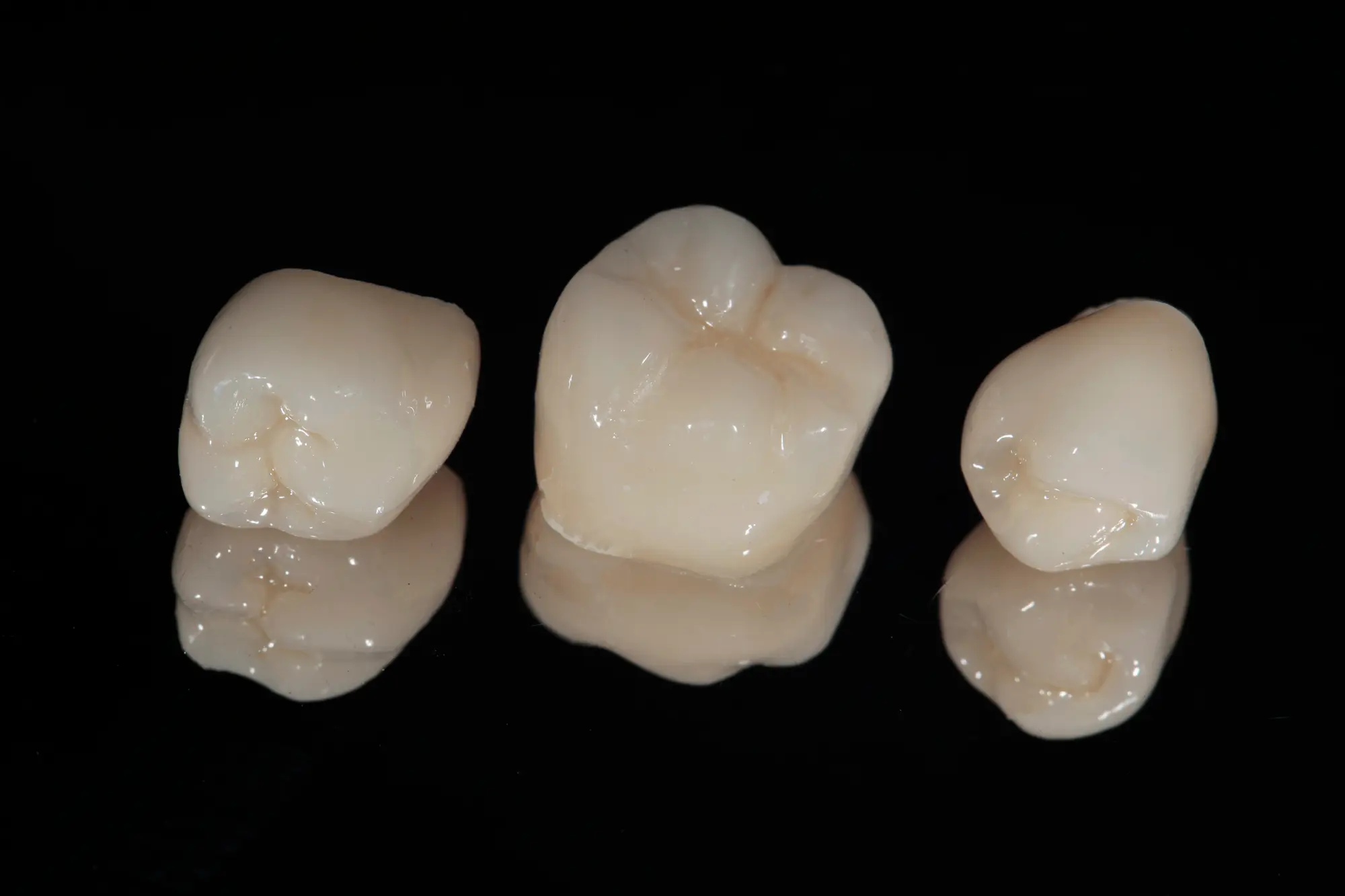 How Pediatric Dental Crowns Provide a Structural Reset for Damaged Baby Teeth