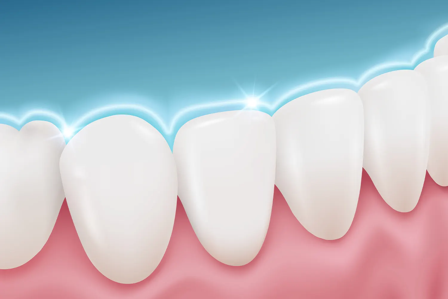 The Power of Silver Diamine Fluoride in Pediatric Dentistry